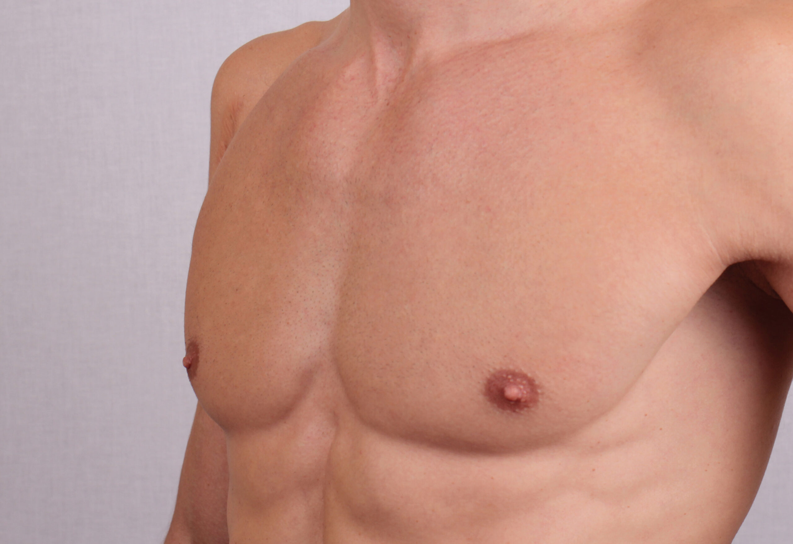 Man embracing a hair-free chest after laser hair removal